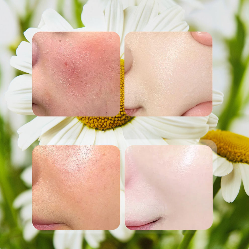 Masque facial en feuille Fykly - Face Mask Skincare avis et prix