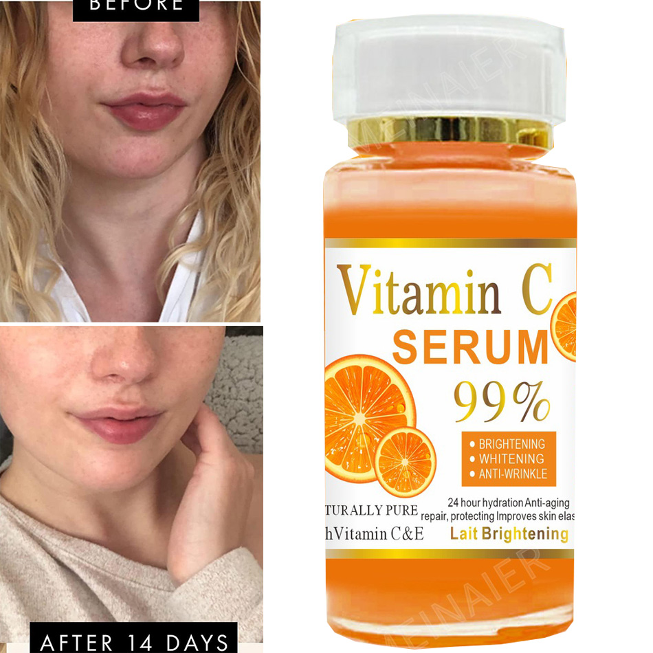 Super 120ml sérum de vitamine  - Vitamin C Serum avis et prix