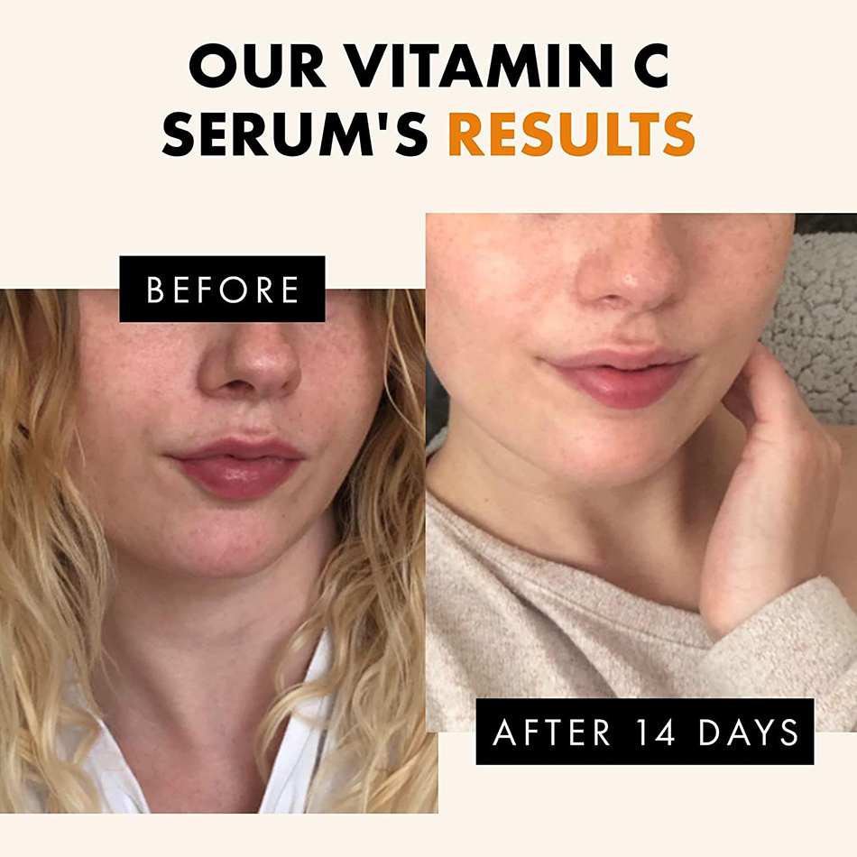 Super 120ml sérum de vitamine  - Vitamin C Serum avis et prix